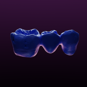 SAMPLE - Bridge dentaire